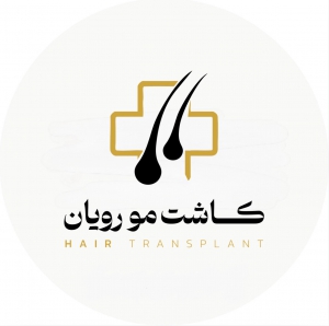 کلینیک کاشت مو رویان
